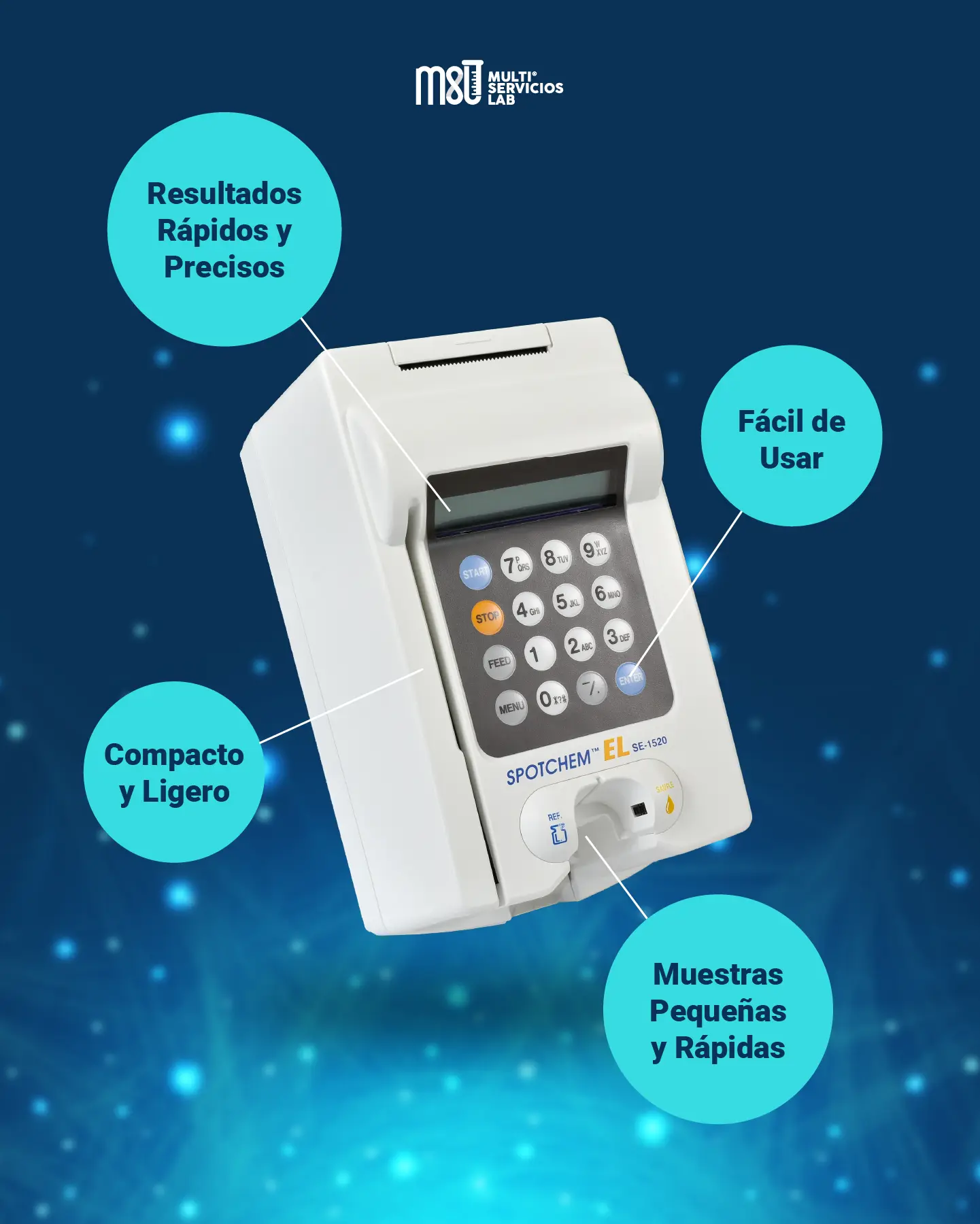 Spotchem EL SE-1520: El Mejor Analizador de Electrolitos para tu Laboratorio