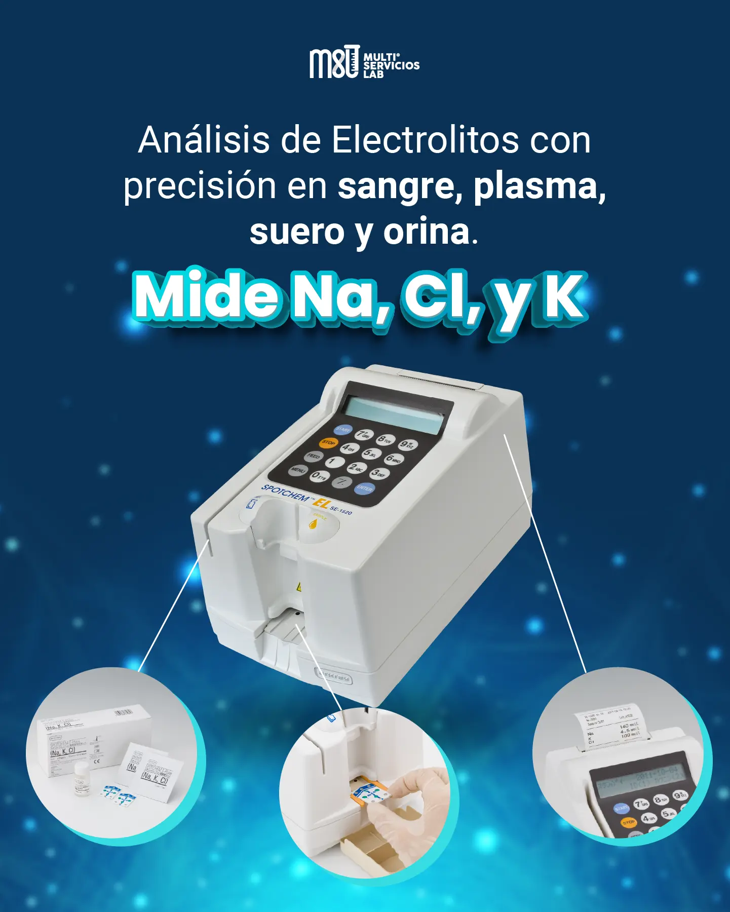 Spotchem EL SE-1520: El Mejor Analizador de Electrolitos para tu Laboratorio