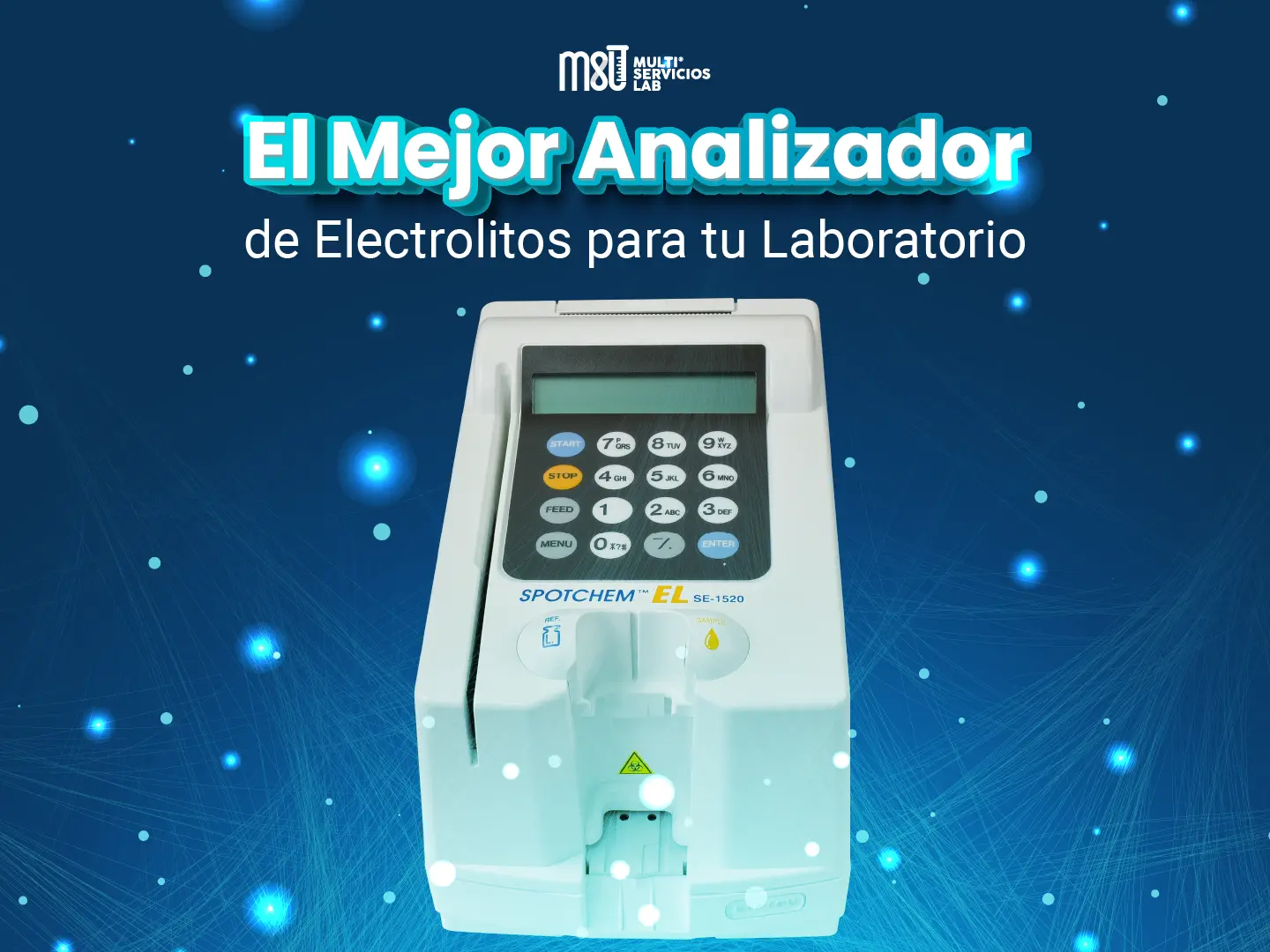 Spotchem EL SE-1520: El Mejor Analizador de Electrolitos para tu Laboratorio