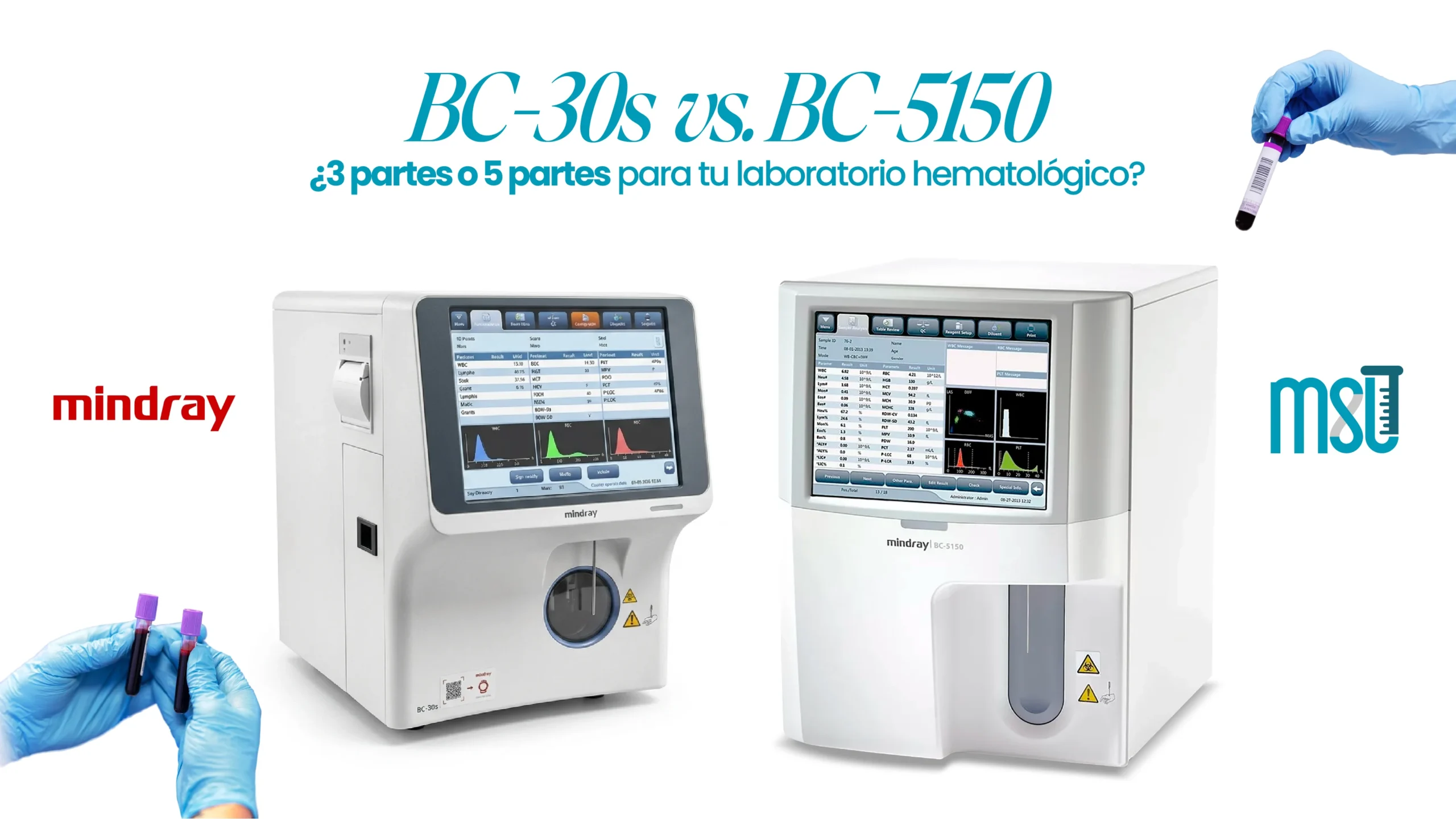 BC-30s vs. BC-5150 Mindray: ¿3 partes o 5 partes para tu laboratorio hematológico?